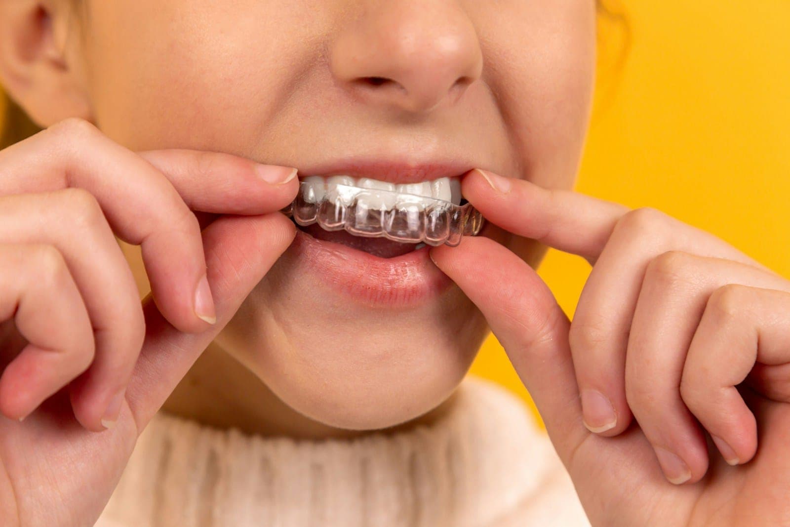 A woman pressing a clear aligner into place over her teeth