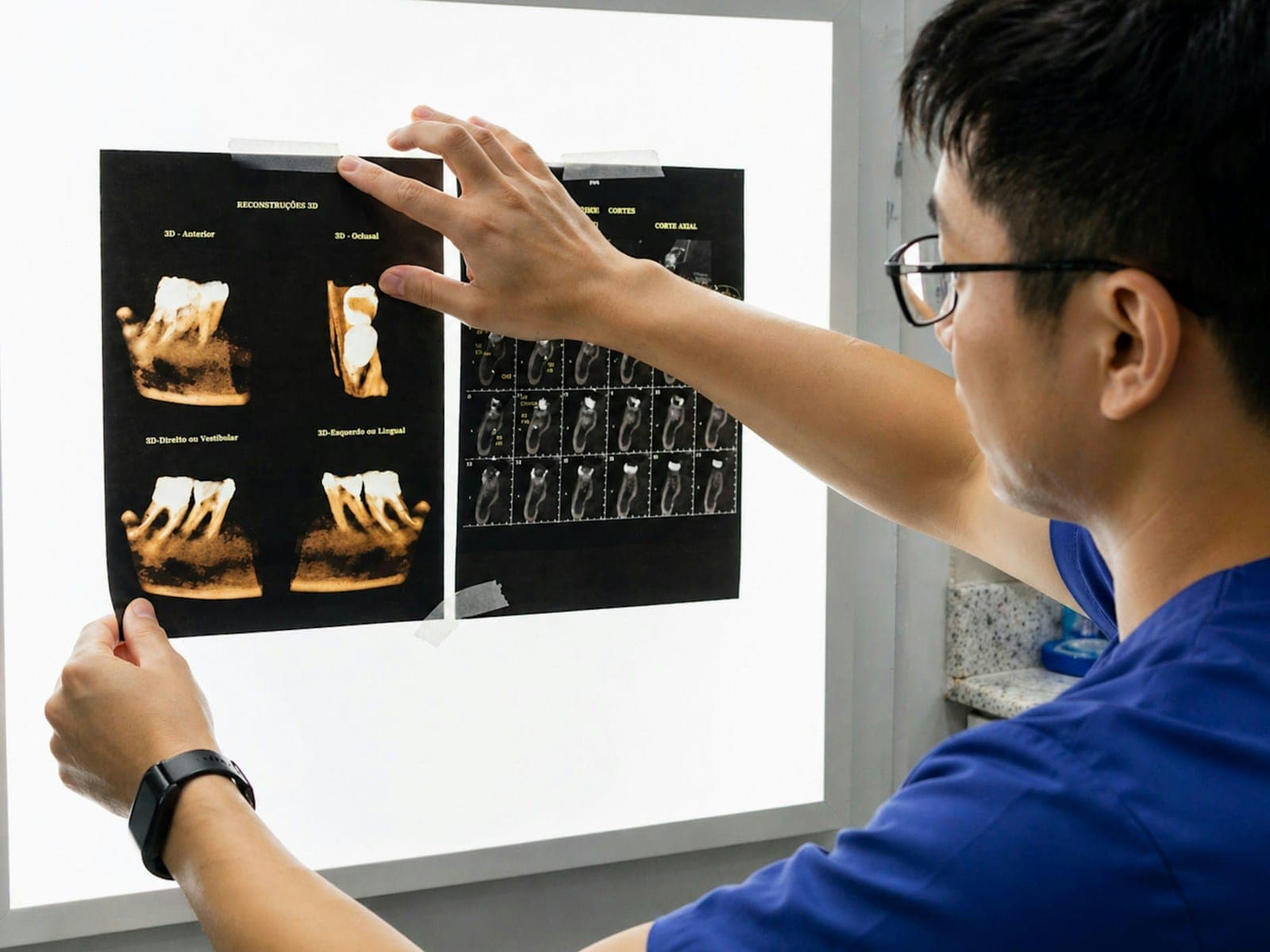 A dentist reviewing printed images of dental implants on a light board